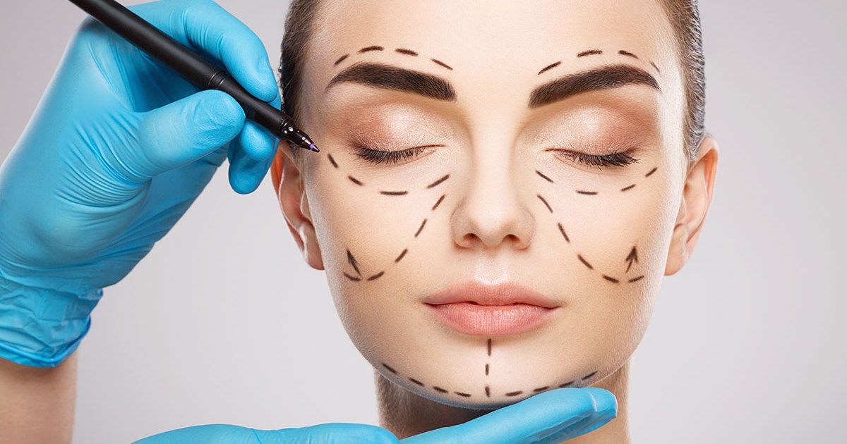 Oberlidstraffung simultan zum Facelift: Wann ist das sinnvoll?