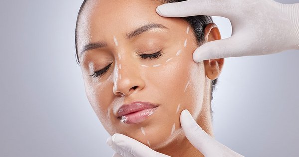 Was unterscheidet ein Deep Plane Facelift von herkömmlichen Methoden?