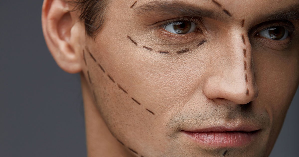 Facelifting für Männer: Worauf muss bei der männlichen Anatomie geachtet werden?